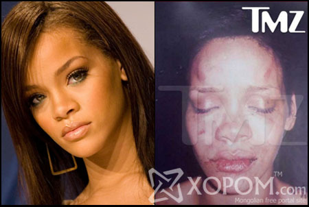 Залуу дуучин бүсгүй Rihanna найз залуу Chris Brown-даа зодуулжээ