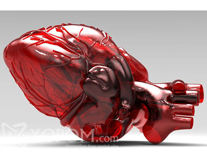 3D-гээр хэвлэсэн зүрхийг хүүхдэд суулгажээ